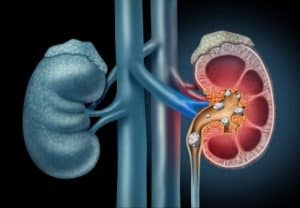 Urology Expert Witness